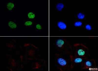 Immunocytochemistry/ Immunofluorescence: Histone H3 [Dimethyl Lys9] Antibody - BSA Free [NB21-1072]